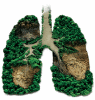 Trees are the Lungs of the earth.